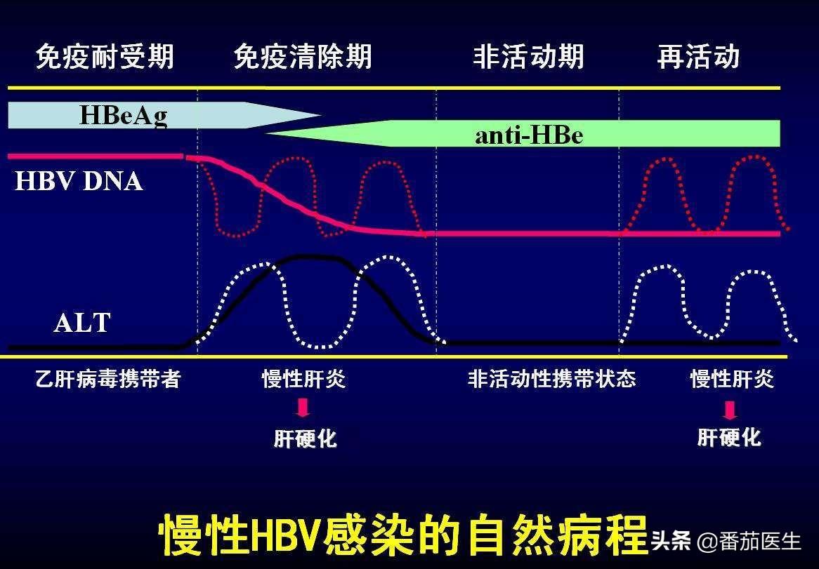 关于大三阳最新治疗方法的探讨